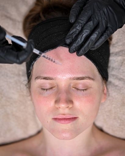Microneedling med C-vitamin 1500,-