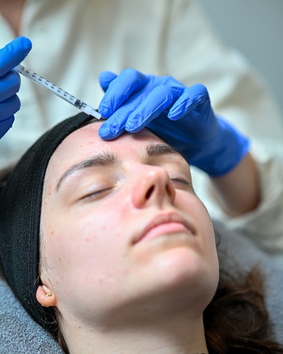 Microneedling