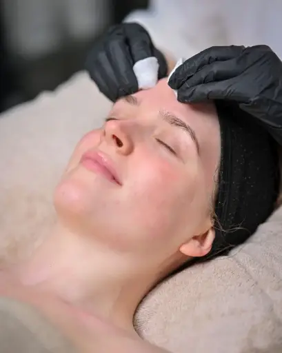 Nano needling 1300,-